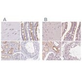 Anti-TREH antibody produced in rabbit Prestige Antibodies&#174; Powered by Atlas Antibodies, affinity isolated antibody, buffered aqueous glycerol solution