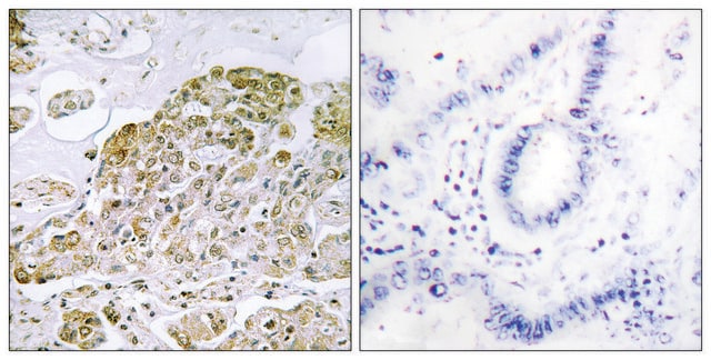 Anti-TFEB antibody produced in rabbit affinity isolated antibody