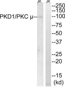 Anti-PKD1 antibody produced in rabbit affinity isolated antibody