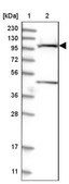 Anti-SLC9A2 antibody produced in rabbit Prestige Antibodies&#174; Powered by Atlas Antibodies, affinity isolated antibody, buffered aqueous glycerol solution