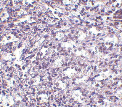 Anti-STIM2 (ab1) antibody produced in rabbit affinity isolated antibody, buffered aqueous solution