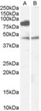 Anti-ZDHHC8 affinity isolated antibody, buffered aqueous solution