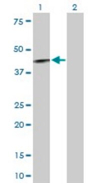 Anti-IL12RB1 antibody produced in rabbit purified immunoglobulin, buffered aqueous solution