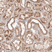 Anti-USH1C antibody produced in rabbit Prestige Antibodies&#174; Powered by Atlas Antibodies, affinity isolated antibody, buffered aqueous glycerol solution, ab3