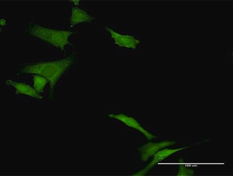 Anti-HABP4 antibody produced in rabbit purified immunoglobulin, buffered aqueous solution