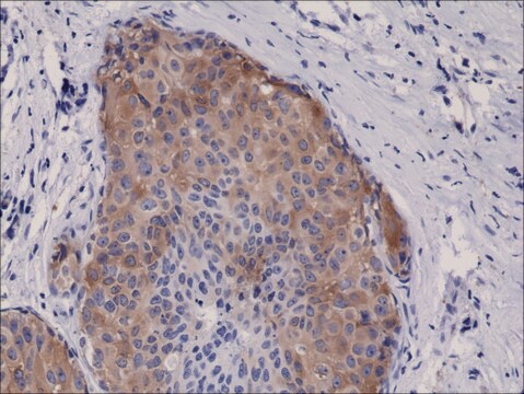 Anti-Phospho Acetyl CoA Carboxylase (Ser79) antibody, Rabbit monoclonal recombinant, expressed in HEK 293 cells, clone RM270, purified immunoglobulin