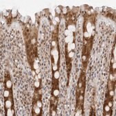 Anti-WDR77 antibody produced in rabbit Prestige Antibodies&#174; Powered by Atlas Antibodies, affinity isolated antibody, buffered aqueous glycerol solution, ab3