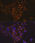 Anti-Caspase-6 Antibody, clone 6D7S2, Rabbit Monoclonal