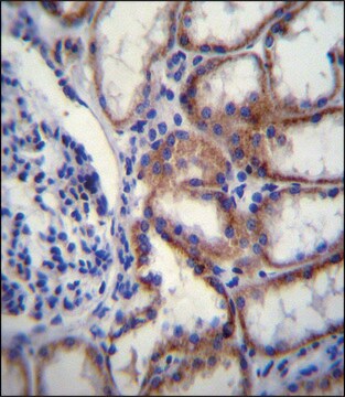 ANTI-COL8A2 (C-TERM) antibody produced in rabbit IgG fraction of antiserum, buffered aqueous solution