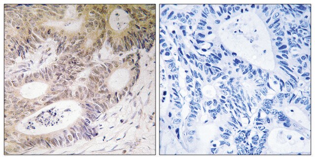 Anti-MSK1 antibody produced in rabbit affinity isolated antibody