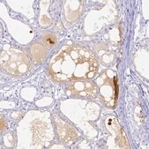 Anti-LTF antibody produced in rabbit Prestige Antibodies&#174; Powered by Atlas Antibodies, affinity isolated antibody, buffered aqueous glycerol solution
