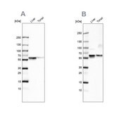 Anti-SERPINA1 antibody produced in rabbit Prestige Antibodies&#174; Powered by Atlas Antibodies, affinity isolated antibody, buffered aqueous glycerol solution