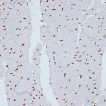 Anti-Phospho-CHEK1-S280 antibody produced in rabbit