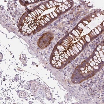 Anti-ADAMTSL2 antibody produced in rabbit Prestige Antibodies&#174; Powered by Atlas Antibodies, affinity isolated antibody, buffered aqueous glycerol solution