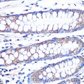 Anti- FGF2 antibody produced in rabbit
