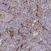 Anti-SLC9A3R2 Prestige Antibodies&#174; Powered by Atlas Antibodies, affinity isolated antibody