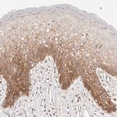 Anti-CXADR antibody produced in rabbit Prestige Antibodies&#174; Powered by Atlas Antibodies, affinity isolated antibody, buffered aqueous glycerol solution