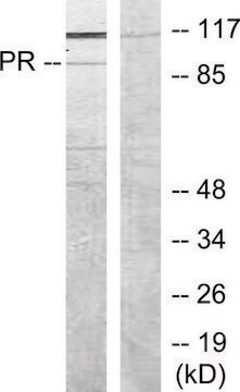 Anti-Progesterone Receptor antibody produced in rabbit affinity isolated antibody