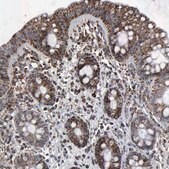 ANTI-HSPA9 antibody produced in rabbit Prestige Antibodies&#174; Powered by Atlas Antibodies, affinity isolated antibody, buffered aqueous glycerol solution