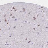 Anti-TMEM35A antibody produced in rabbit Prestige Antibodies&#174; Powered by Atlas Antibodies, affinity isolated antibody, buffered aqueous glycerol solution