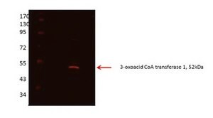 Anti-OXCT1 (AB2) antibody produced in rabbit affinity isolated antibody