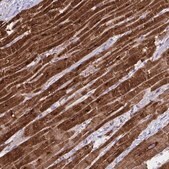 Anti-ATP2A2 antibody produced in rabbit Prestige Antibodies&#174; Powered by Atlas Antibodies, affinity isolated antibody, buffered aqueous glycerol solution