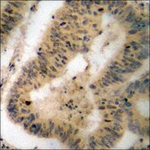Anti-phospho-p90 RSK (pThr359+Ser363) antibody produced in rabbit affinity isolated antibody