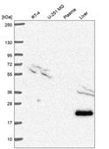 Anti-Tagln Antibody Produced In Rabbit Prestige Antibodies&#174; Powered by Atlas Antibodies, affinity isolated antibody, buffered aqueous glycerol solution