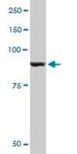 Monoclonal Anti-PYGM antibody produced in mouse clone 2C4, purified immunoglobulin, buffered aqueous solution