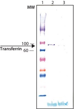 Anti-Transferrin antibody produced in chicken affinity isolated antibody, buffered aqueous solution