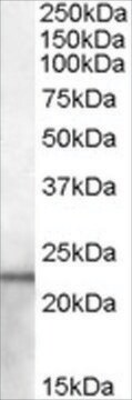 Anti-Lipocalin 2/NGAL (AB2) antibody produced in goat affinity isolated antibody, buffered aqueous solution