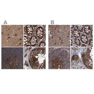 Anti-PEX5 antibody produced in rabbit Prestige Antibodies&#174; Powered by Atlas Antibodies, affinity isolated antibody, buffered aqueous glycerol solution