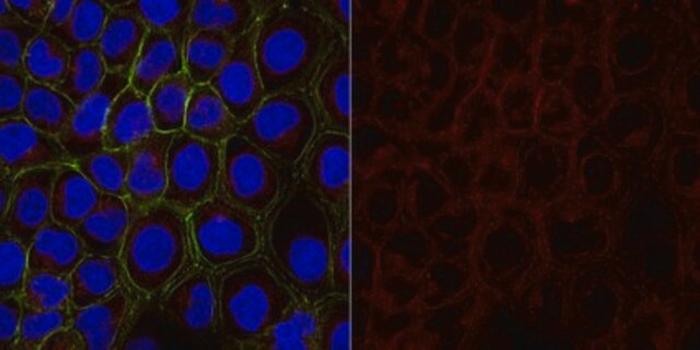 Anti-Cytokeratin 5,6 Antibody, clone D5/16B4, Alexa Fluor&#8482; 488 clone D5/16B4, from mouse, ALEXA FLUOR&#8482; 488