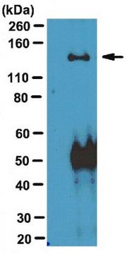 Anti-WASH complex subunit 7 (SWIP) Antibody from rabbit