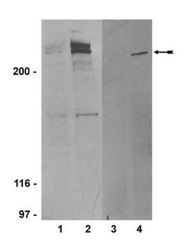 Anti-phospho-ATM (Ser1981) Antibody, clone 10H11.E12 clone 10H11.E12, Upstate&#174;, from mouse