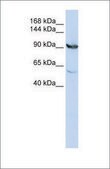 Anti-MTHFD1 antibody produced in rabbit affinity isolated antibody
