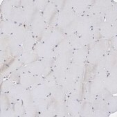 Anti-P2RY10 antibody produced in rabbit Prestige Antibodies&#174; Powered by Atlas Antibodies, affinity isolated antibody, buffered aqueous glycerol solution
