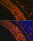 Anti-&#945;-Smooth Muscle Actin (ACTA2) Antibody, clone 2V4L9, Rabbit Monoclonal