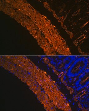 Anti-&#945;-Smooth Muscle Actin (ACTA2) Antibody, clone 2V4L9, Rabbit Monoclonal