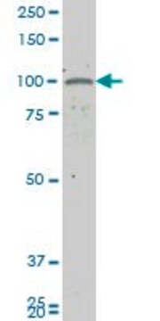 ANTI-GUCY2C antibody produced in mouse clone 2G7, purified immunoglobulin, buffered aqueous solution