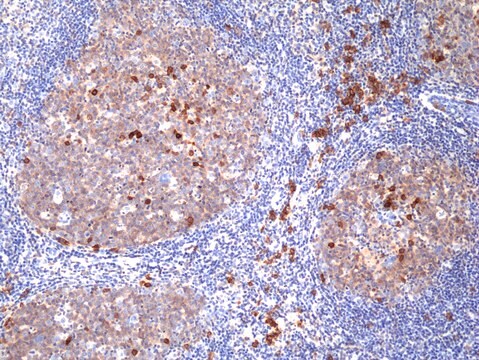 Anti-CD38 Rabbit Monoclonal Antibody