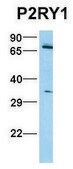 Anti-P2RY1 (N-terminal) antibody produced in rabbit affinity isolated antibody