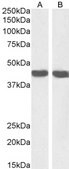 Anti-Smooth Muscle &#945;-Actin antibody produced in goat affinity isolated antibody, buffered aqueous solution