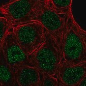 Anti-PPARG antibody produced in rabbit Prestige Antibodies&#174; Powered by Atlas Antibodies, affinity isolated antibody