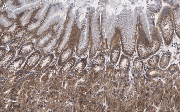 Anti-MYO1C Antibody, clone 4B19, ZooMAb&#174; Rabbit Monoclonal recombinant, expressed in HEK 293 cells