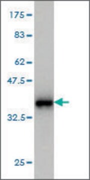 Monoclonal Anti-S100A8 antibody produced in mouse clone 2H2, purified immunoglobulin, buffered aqueous solution