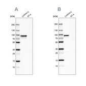 Anti-TGM2 antibody produced in rabbit Prestige Antibodies&#174; Powered by Atlas Antibodies, affinity isolated antibody, buffered aqueous glycerol solution