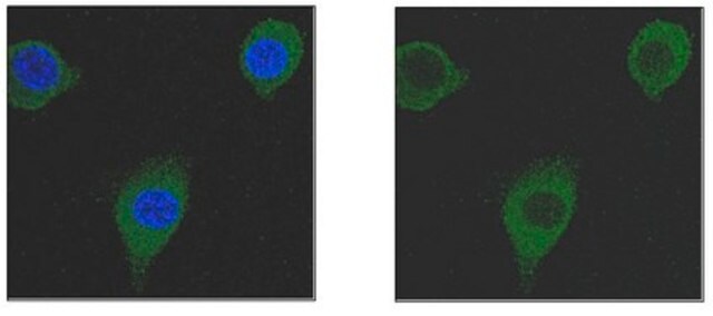 Anti-Transgelin/SM22a Antibody, clone 20F2.2 clone 20F2.2, from mouse