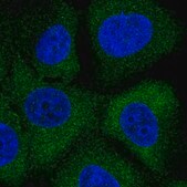 Anti-MAP2K2 antibody produced in rabbit Prestige Antibodies&#174; Powered by Atlas Antibodies, affinity isolated antibody, buffered aqueous glycerol solution