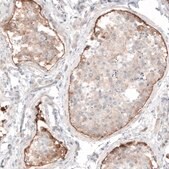 Monoclonal Anti-LAMA1 antibody produced in mouse Prestige Antibodies&#174; Powered by Atlas Antibodies, clone CL3087, purified immunoglobulin, buffered aqueous glycerol solution